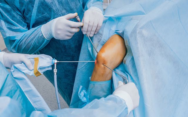 Knee Replacement Surgery
